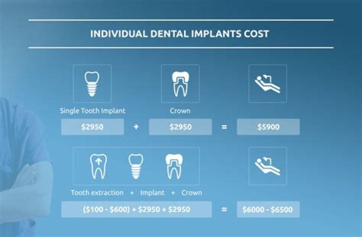 Average cost of dental implants