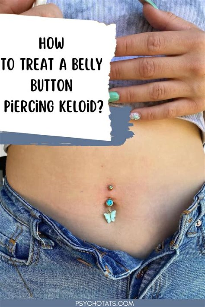 Belly button keloid - How To Discuss