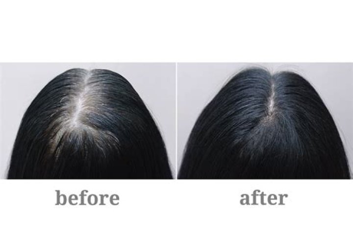 Biotin results after 1 week