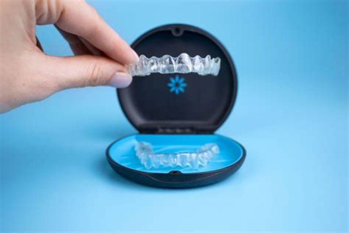 Byte aligners reviews - How To Discuss