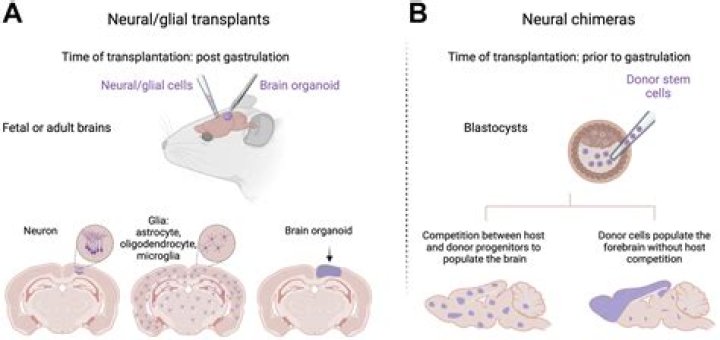 Can Daphne be transplanted