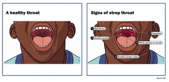 Do Cats And Dogs Get Strep Throat