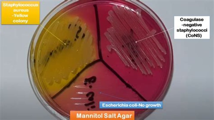 Does Bacillus cereus grown on mannitol salt agar
