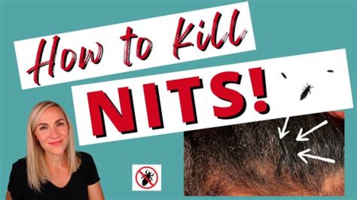 Does Nix actually kill nits