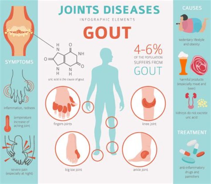 Does vodka affect gout