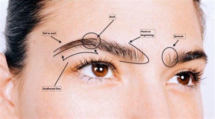 Eyebrow implants - How To Discuss