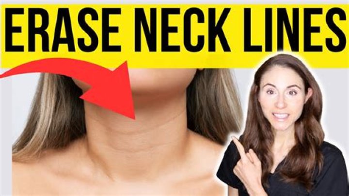 Horizontal neck lines - How To Discuss