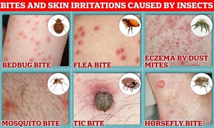 How do bed bugs bite