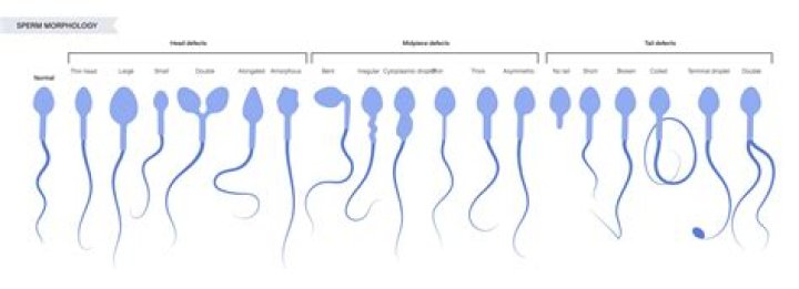How much does sperm sorting cost