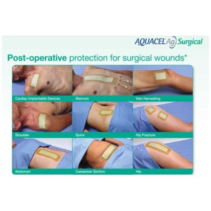 Is a pacemaker a surgical wound for Oasis