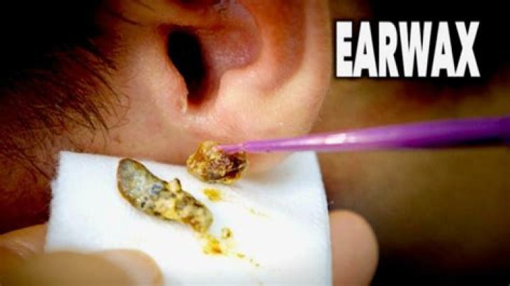 Is Ear Wax dangerous