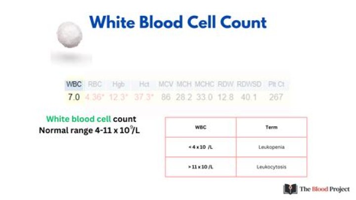 Is your white blood count high with cancer