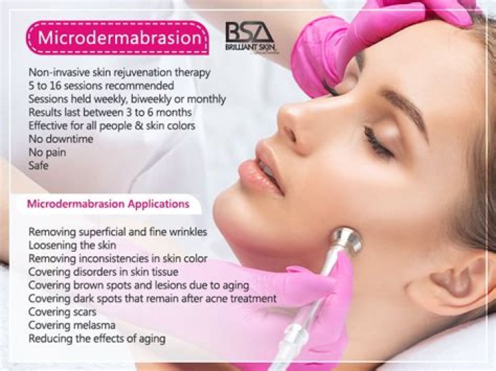 Microderm infusion - How To Discuss