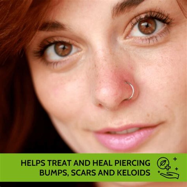 Nose Piercing Scar - How To Discuss