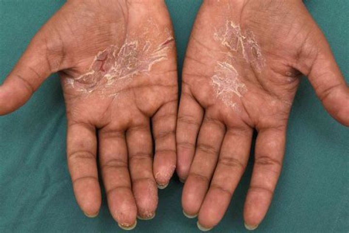 Quick Answer: Do Mediteranean Date Palms Make Dogs Sick