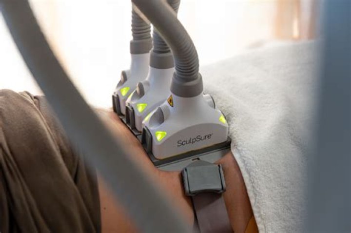 Sculpsure cost - How To Discuss