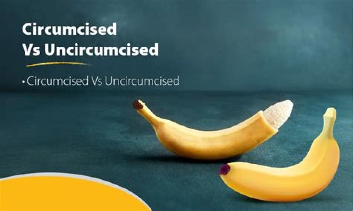 Should I circumcise my son pros and cons