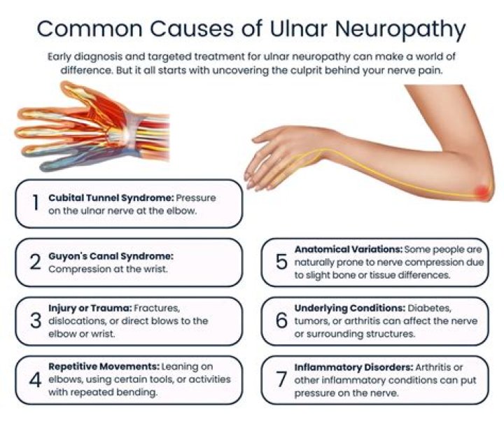 What causes Neuropraxia