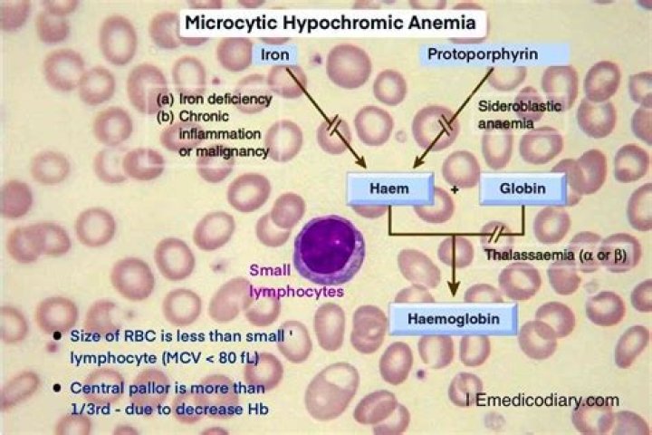 What does Microcytosis 2 mean
