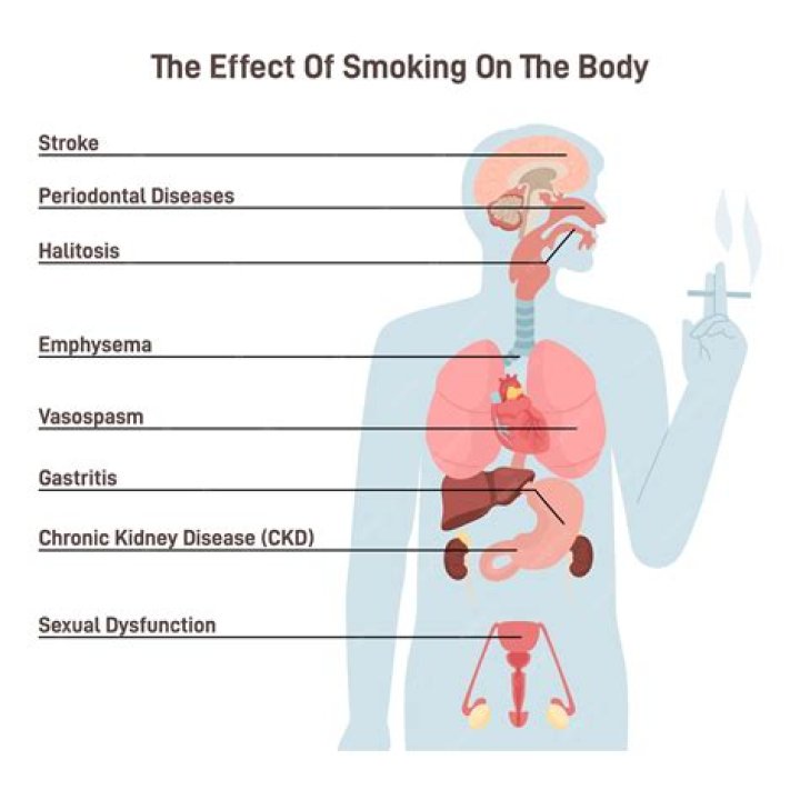 What does smoking do to your bronchi