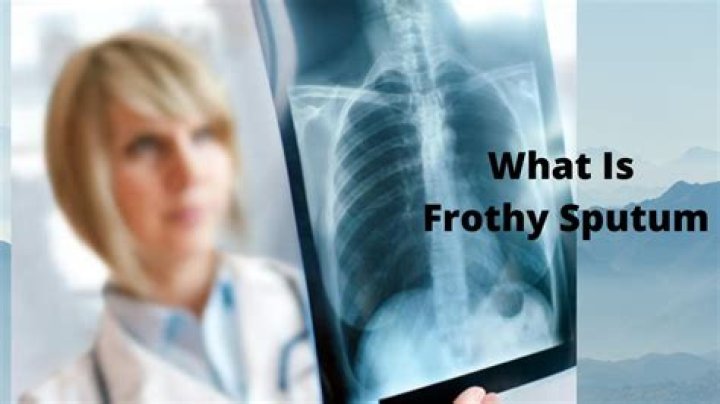 What does white frothy sputum indicate