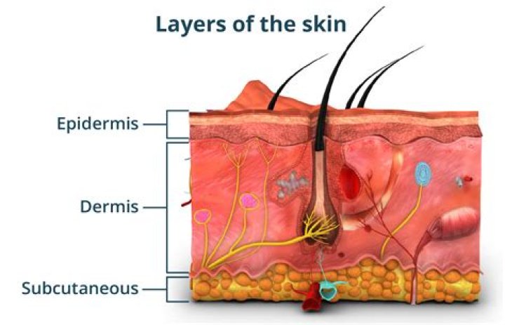 What is a linear crack in the skin extending into the dermis