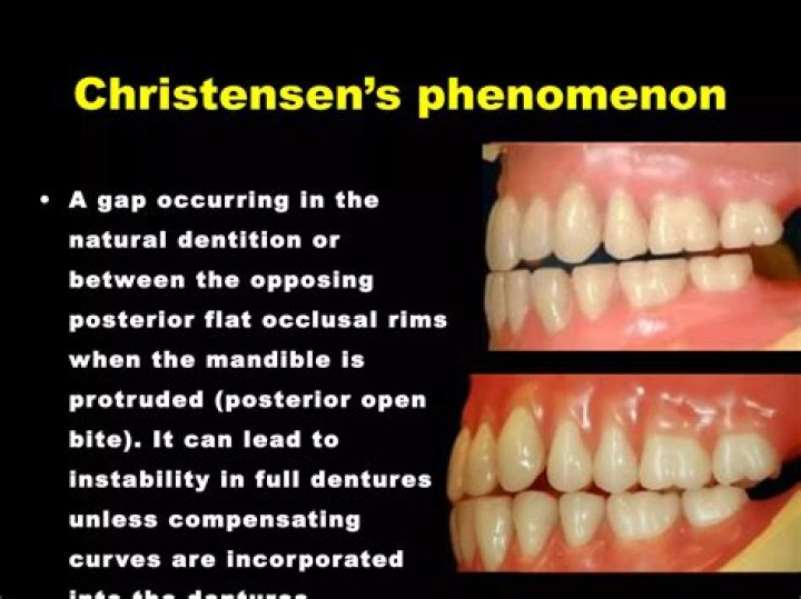 What is Christensen phenomenon
