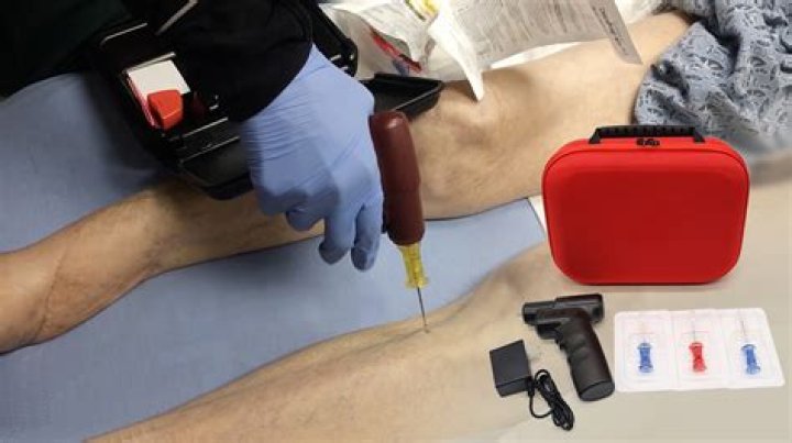 What is IV IO access