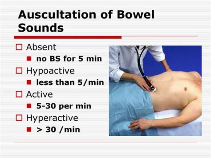What is the normal range of bowel sounds