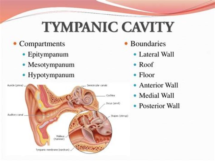 What is the sound of tympany
