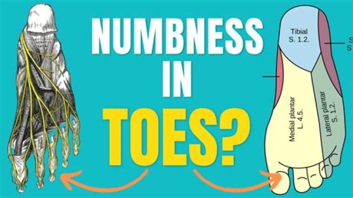 What To Do For Numb Toes