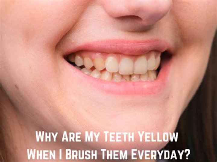 Why are my teeth yellow when i brush them everyday