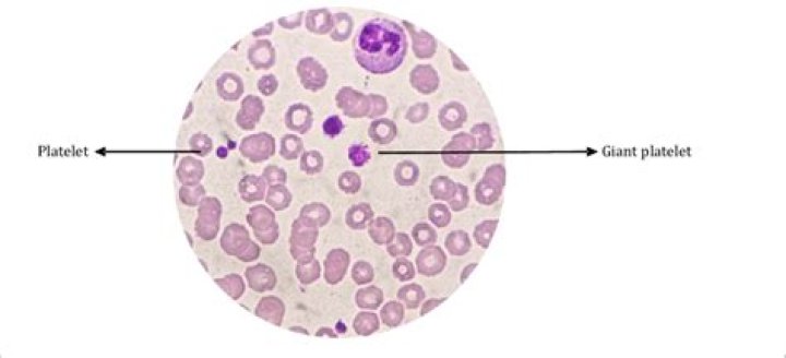 Why would platelets be high in a dog